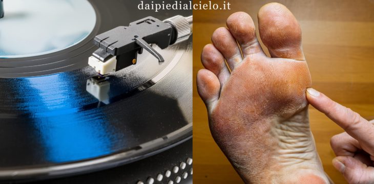 I microsolchi sui dischi in vinile somigliano ai dermatoglifi dei piedi